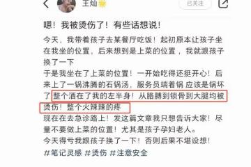 杜淳老婆帶女兒吃飯，左半身被沸湯燙傷，幸運及時跟孩子換了位置