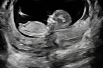 阿嬌前夫再當爸！賴弘國曬B超照官宣三婚妻子懷二胎：歡迎龍寶
