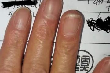「月牙」越多，身體越好？許多人都理解錯了，看看自己屬於哪種