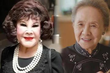 「科技臉」與「自然臉」老後大對比！女星真實寫照曝光