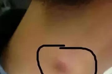 體內有癌，脖子先知？提醒：脖子出現2個異常，小心是癌症找上門