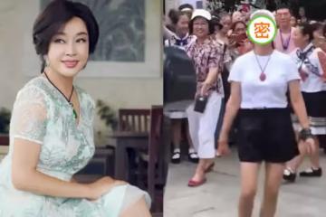69歲劉曉慶，穿短褲裝年輕，臉頰飽滿顯怪異，網友：沒有普通老人看起來舒服