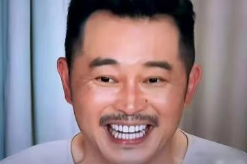 沙溢牙白到失真，金晨烤瓷牙出戲，明星假牙各有各的尷尬