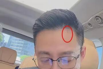 不出三年必離婚！新婚第二天汪小菲額頭現抓痕，看店馬筱梅未跟隨