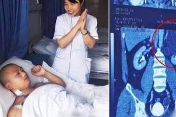 回顧：28歲男子力大無窮，檢查出有4個腎，妻子回應：他身體很好