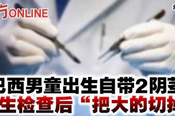 巴西男童出生自帶2陰莖 醫生檢查後「把大的切掉」