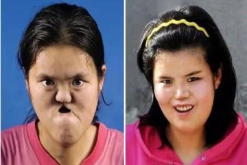 回顧農民撿到坑面女嬰，哥哥做苦力為妹妹整容，變美後她嫁給哥哥