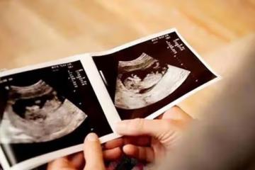 回顧:植物人女子腹部凸起,醫生檢查發現懷孕,丈夫堅持生下來