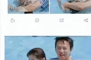 關曉彤慘了！鹿晗浮腫發福，右手長了很多潰爛型血瘡，疑得了髒病