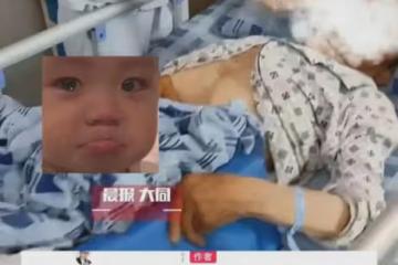 84歲父親顱內出血昏迷6天6夜，沒法做手術兒子無奈拔管，下秒淚崩