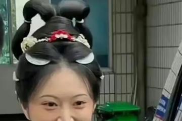 景甜整容失敗！臉腫脹僵硬，眼睛縮小一倍，女神慘變悲傷蛙太可怕