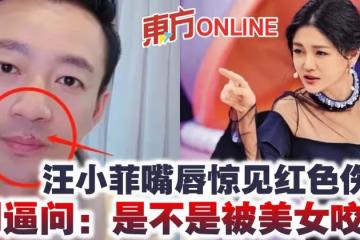 汪小菲嘴唇驚見紅色傷口 網逼問:是不是被美女咬?