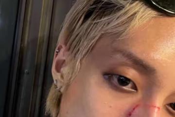 韓國首位公開出櫃男歌手遭路人暴打辱罵:骯髒的GAY!