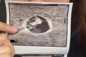 黃翠如成功懷孕,視後江美儀與吳家樂回憶她流產後狀態,心痛又堅強