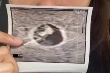寶寶性別保密!蕭正楠擔起養家責任,認太太屬高齡產婦需停工休息