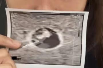 TVB大熱小生再提心酸往事,因一時失言人氣暴跌,父母遭牽連被質問養子不教