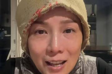 香港女星乳腺癌復發，順利完成細胞免疫治療，經常以光頭形象示人