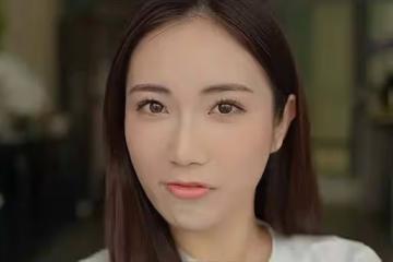 TVB前女星整容醫美長達十年，踏入娛樂圈不自信，打過六種美容針