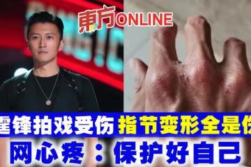 謝霆鋒拍戲受傷 指節變形全是傷痕 網心疼:保護好自己