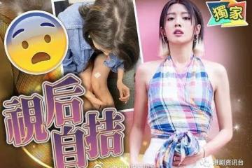TVB當紅花旦獻身自扎!「學醫」再沖視後殊榮