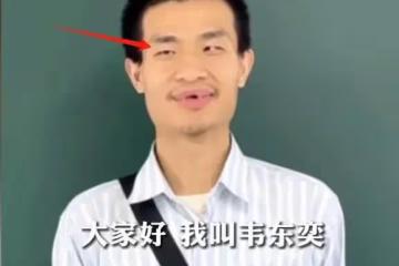韋東奕近照流出,家屬曝光其牙齒脫落原因,堂哥透露韋神後續安排
