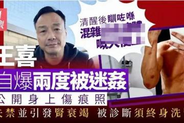 港星王喜自曝被兩度侵犯後患腎衰竭,熟人作案沒報警,需終身洗腎