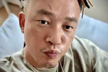 阿Ben拍戲受傷「白衣全是血」！　首曝傷勢照頭縫數針