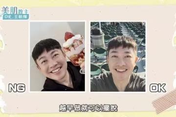 50歲李明川「動刀改善除眼袋」驚人成果曝光! 認昔被擊垮:看起來好可憐