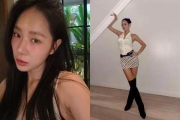 SISTAR昭宥168cm「體重跌破50kg」　認瘦太快出現副作用：經常頭暈