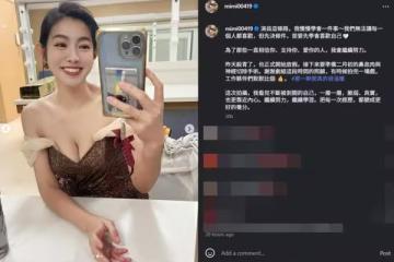 米可白殺青突宣布動刀！預告「切除神經」 認了：每天頭痛不舒服