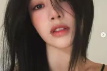 蔡瑞雪突PO「脖子紅腫照」！厚敷藥膏慘況曝 認了確診這病症：治療中