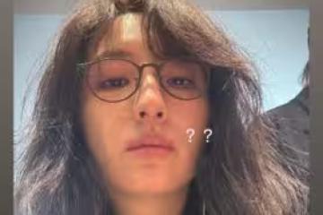 柯佳嬿素顏「特寫臉部異狀」無P照曝 錯愕問:這是什麼過敏反應?