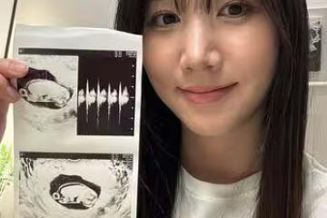 前Apink洪瑜暻宣布當媽！　結婚3年喜曬超音波照