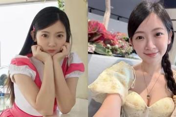 優格姐姐蕁麻疹發作「腫到吞咽困難」　心慌求解：萬念俱灰的感覺