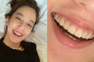 練舉重咬牙太用力　陳庭妮咬斷一小角門牙