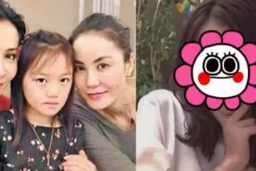 有種「驚豔」叫李嫣摘掉兔唇,顏值氣質不輸王菲, 網友:美到我了
