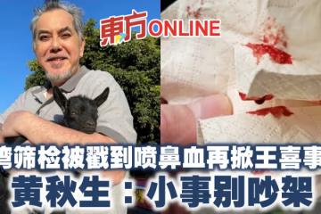 台灣篩檢被戳到噴鼻血再掀王喜事件 黃秋生:小事別吵架