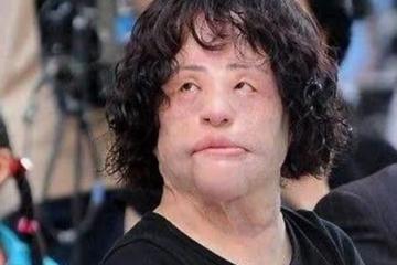 她天生麗質卻痴戀整容，後因意外導致毀容，去世時年僅57歲