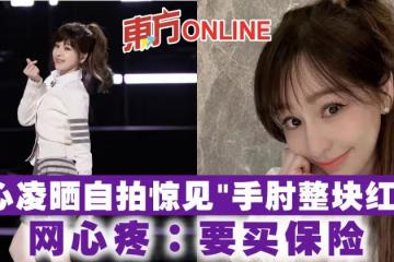 王心凌曬自拍驚見「手肘整塊紅腫」　網心疼：要買保險