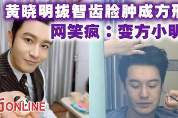 黃曉明拔智齒臉腫成方形 網笑瘋:變方小明了