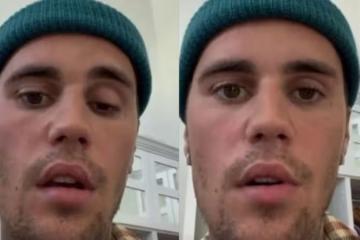 Justin Bieber驚爆罹罕病 「臉歪嘴斜」模樣曝光