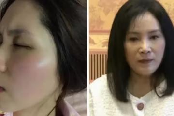 余苑綺罹癌再手術!李亞萍悲曝「併發腎積水」最近病況曝光 臉暴瘦凹陷「像是骷髏人」癌細胞來不及殺