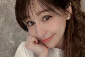 曾被質疑過度整容　王心凌臉部僵硬全因患怪病
