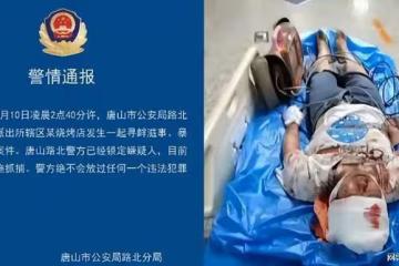 唐山事件曝光人:每天都遭網暴,睡眠只有3.4小時,精神已崩潰