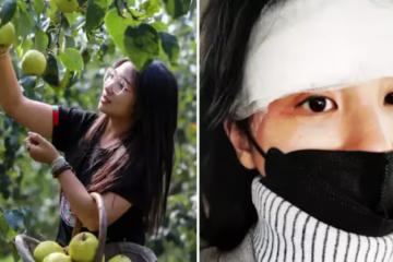 女子跑到同事家果園摘梨吃,不慎被落梨砸中眼睛,向同事索賠13萬,他委屈:朋友還能做嗎