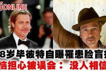 58歲畢彼特自曝罹患臉盲症 苦惱擔心被誤會: 沒人相信我