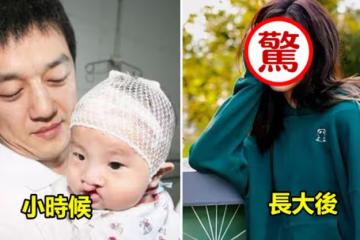 有種「驚艷式長大」叫做16歲李嫣!「唇齶裂」蛻變變成氣質美女,顏值清新可人看起來像「迷你版王菲」
