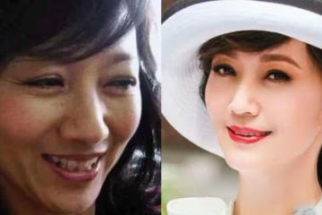 「凍齡」原來是騙人的，去掉美顏的趙雅芝劉嘉玲，終究逃不過歲月