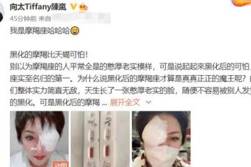 向太雙眼嚴重受傷！厚紗布遮半張臉血絲可怖，否認兒子出軌仍遭罵