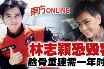 林志穎面骨碎裂恐毀容 擬亞洲權威做「臉骨重建」